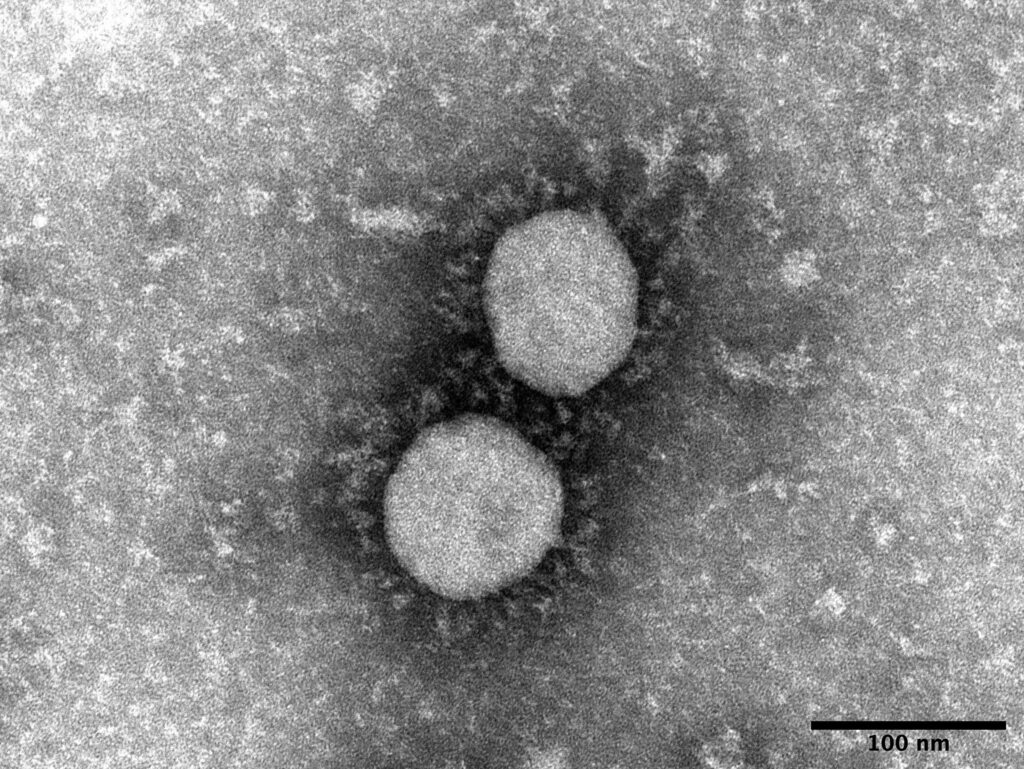 画像提供：国立感染症研究所　SARS-CoV-2 Variant of Concern, Lineage B.1.617.2, Delta
